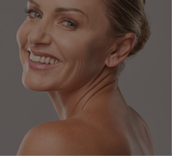 age spots
