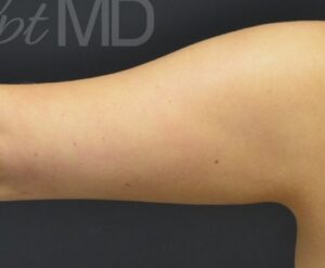 After Image: Arms