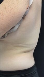 After Image: Flanks