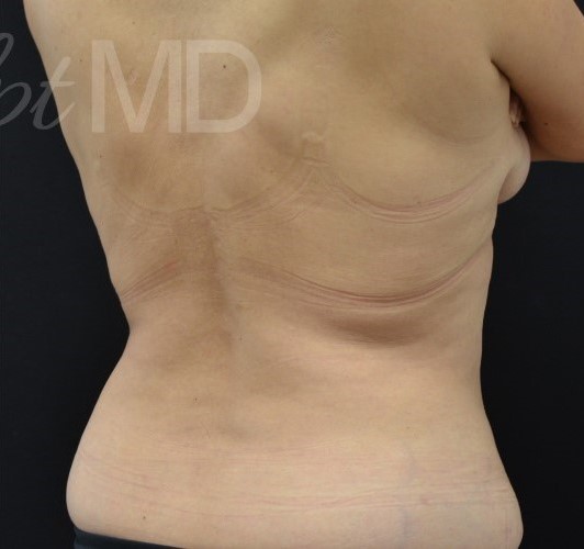 After Image: Flanks - right-back-oblique