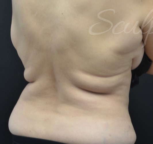 Before Image: Flanks - right-back-oblique