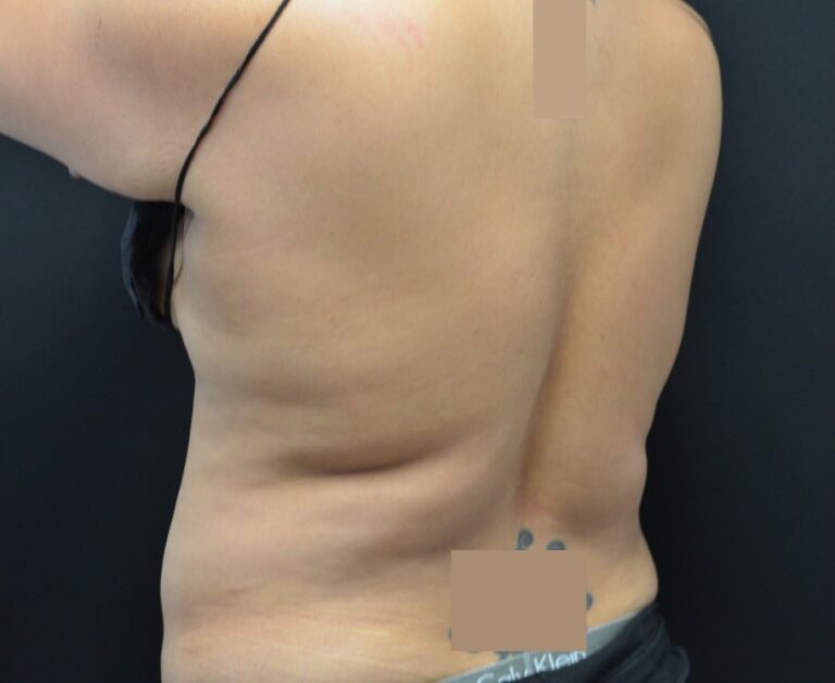 Before Image: Flanks - left-back-oblique
