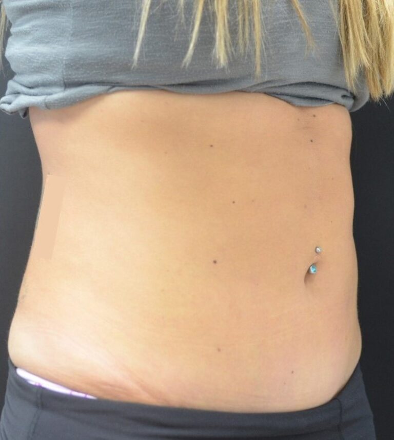 After Image: Flanks - right-front-oblique
