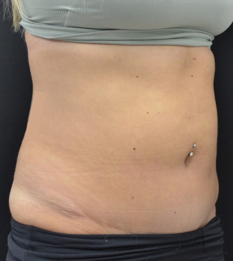 Before Image: Flanks - right-front-oblique