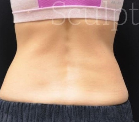 Before Image: Flanks - back