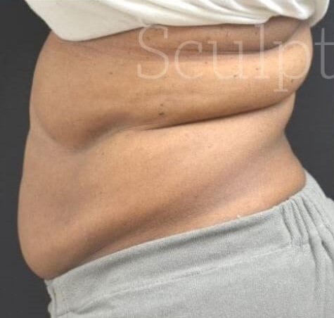 Before Image: Flanks - left-side