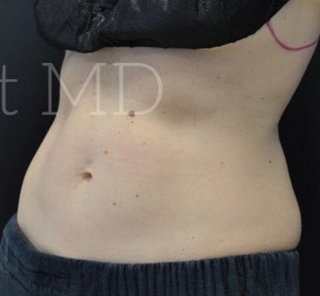 After Image: Flanks - left-front-oblique