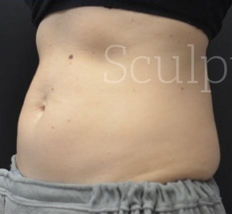 Before Image: Flanks - left-front-oblique