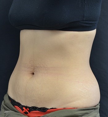After Image: Back - left-front-oblique