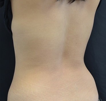 After Image: Back - left-back-oblique