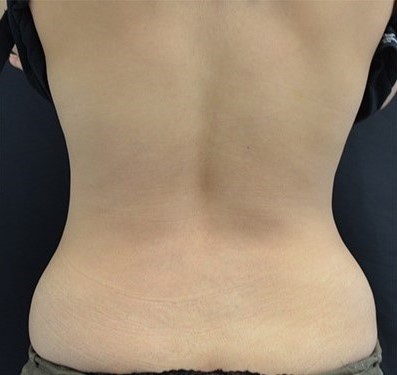 After Image: Back - back