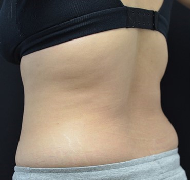 Before Image: Back - left-back-oblique
