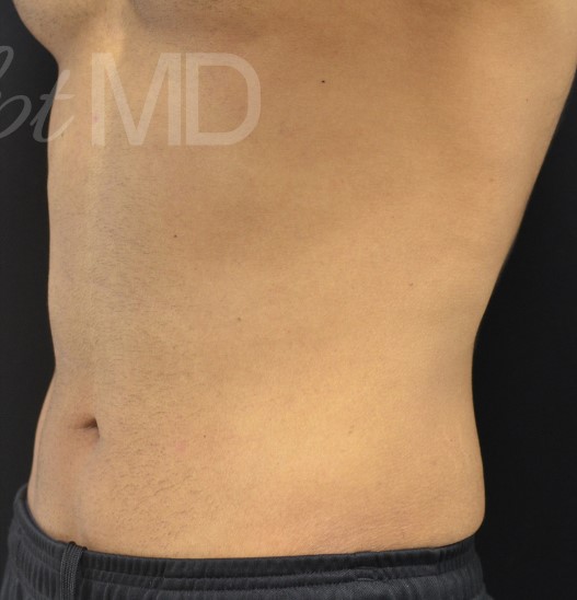 After Image: Flanks - left-front-oblique