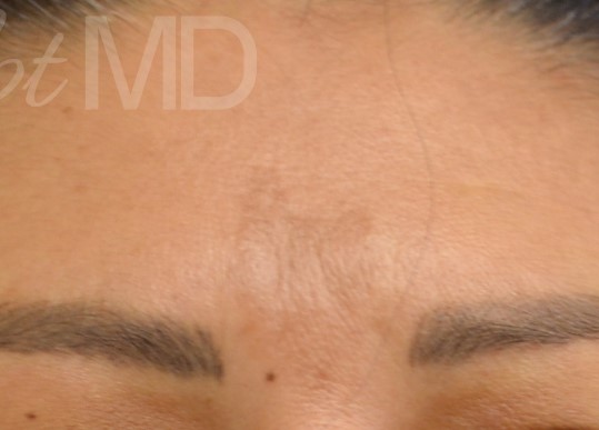 After Image: Esthetician Services - front