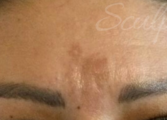 Before Image: Esthetician Services - front