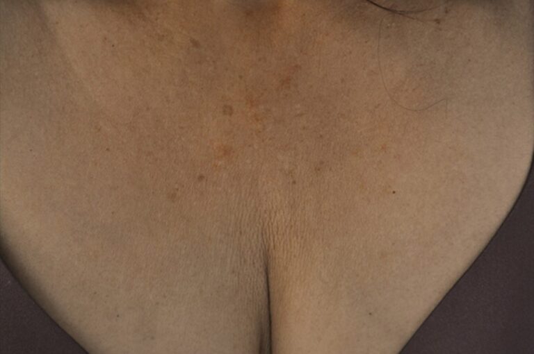 After Image: Decollette - front