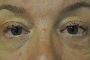After Image: Eyes