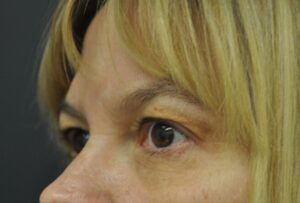 After Image: Eyes
