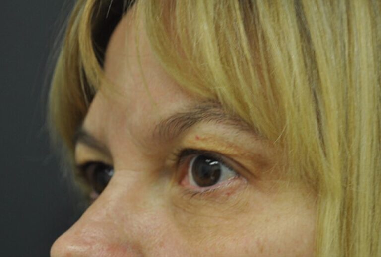 After Image: Eyes - left-front-oblique
