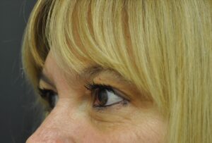 Before Image: Eyes
