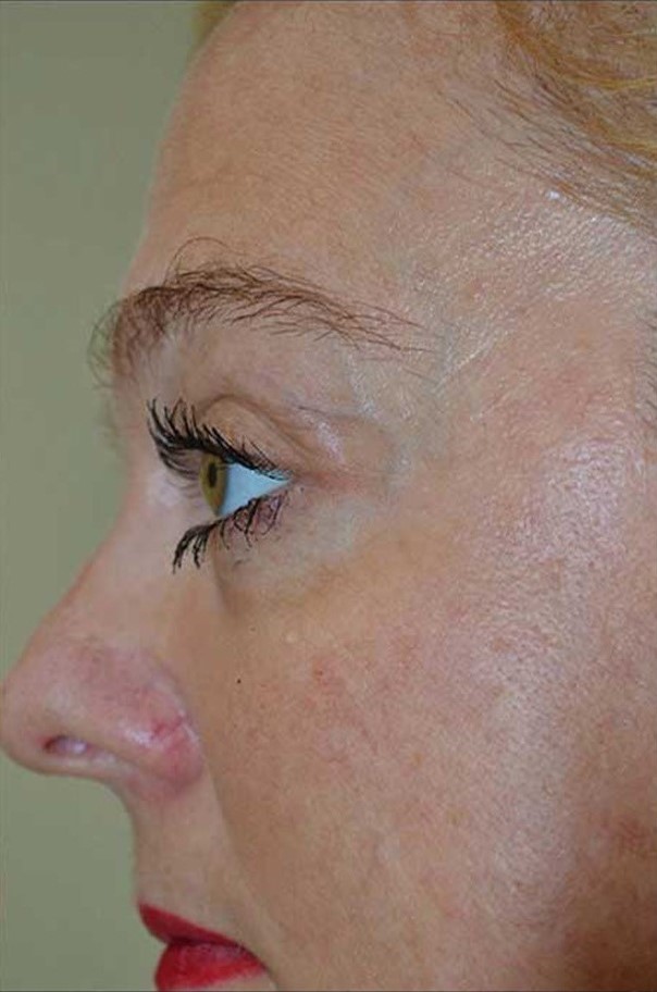 After Image: Eyes - left-side