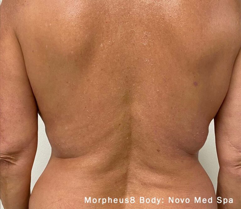 After Image: Body - back