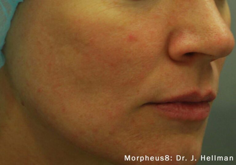 After Image: Face - right-front-oblique