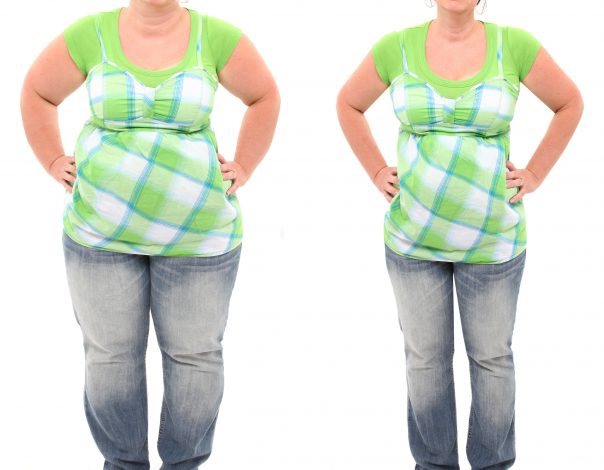What is CoolSculpting®? 65ce40fd0b794.jpeg